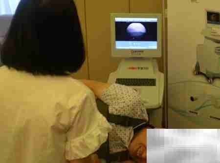 胶囊胃镜的优势解析