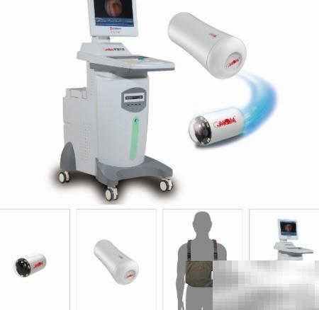 胶囊胃镜优势解析与选择指南