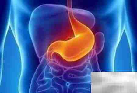 胶囊胃镜的五大优势