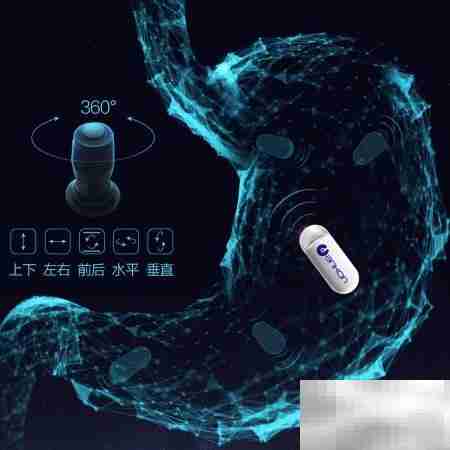 胶囊胃镜的五大优势