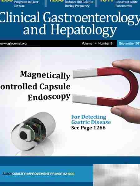 胶囊胃镜的五大优势