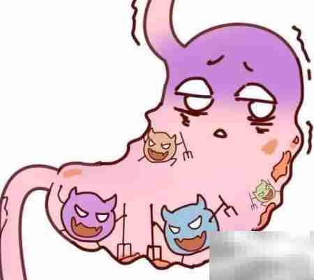 照胃镜前注意事项